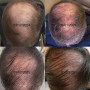 Shampoing Croissance Cheveux - 3 Mois
